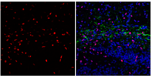 使用 Olig2 对小鼠海马进行免疫荧光分析
