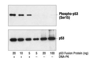 对 p53 融合蛋白进行蛋白质印迹法分析