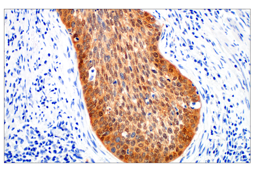 在子宫颈中进行 p16 INK 4A 的免疫组织化学分析