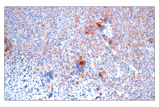 使用 CD40 (E2Z7J) Rabbit mAb 对石蜡包埋的 Renca 同源肿瘤进行免疫组织化学分析。
