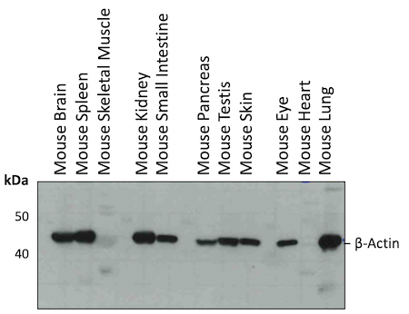 WB 分析小鼠组织 β-肌动蛋白