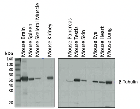 WB 分析小鼠组织 β-微管蛋白