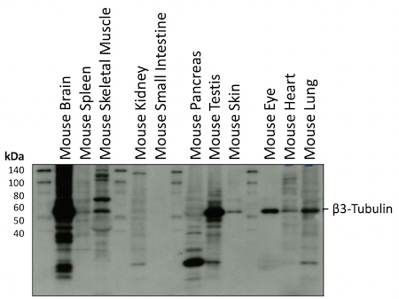 WB 分析小鼠组织 β3-微管蛋白