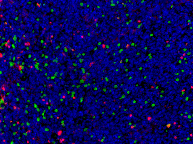 使用 CD8 和 CD3 探测小鼠 4T1 肺转移