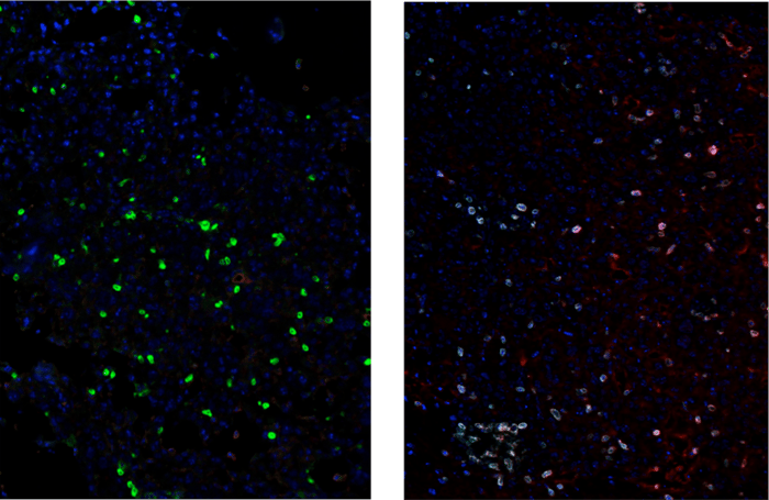 小鼠胶质母细胞瘤肿瘤的多重 IHC 分析