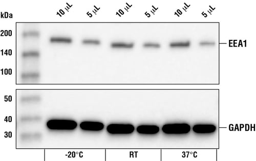 在 20ºC、室温和 37ºC 下对 SK-MEL-28 细胞提取物进行蛋白质印迹法分析
