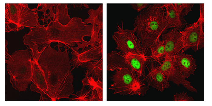 CST 抗体：HIF-1α (D1S7W) XP® Rabbit mAb