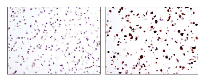 20-CEP-60018 IHC 图像