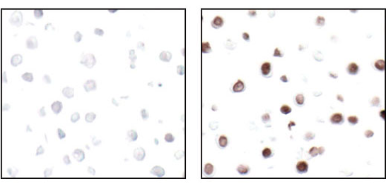 使用 Phospho-Histone H2A.X 对未经处理或经过紫外线处理的石蜡包埋的 HT-29 细胞进行免疫组织化学分析