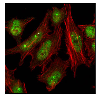 使用 53BP1 Antibody 对 Hela 细胞进行共聚焦免疫荧光分析