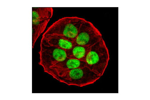 对 HT-29 细胞进行共聚焦免疫荧光分析