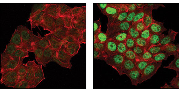 对 MCF-7 细胞进行共聚焦免疫荧光分析。