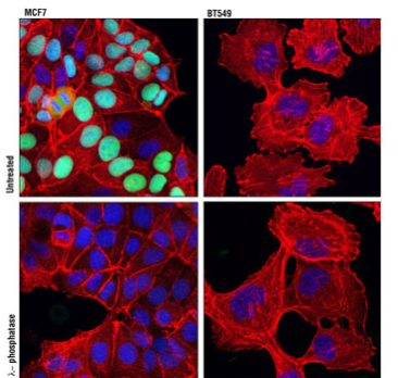 对 MCF7 细胞进行共聚焦免疫荧光分析