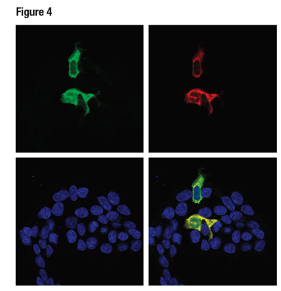 使用 Cas9 (S. pyogenes) (E7M1H)（绿色）和 Myc-Tag (9B11)（红色）对瞬时转染带有 myc 标签的 Cas9（酿脓链球菌）表达载体的 293T 细胞进行共聚焦免疫荧光分析。