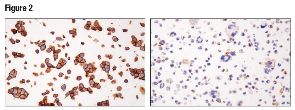 使用 Nectin-2/CD112 (D8D3F) 对石蜡包埋的 RT4 细胞沉淀物（左图）或 HDLM-2 细胞（右图）进行蛋白质印迹分析