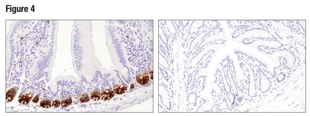 使用 Olfm4 (D6Y5A) 对石蜡包埋的正常小鼠小肠 （左图）和结肠 （右图）细胞进行免疫组织化学分析。