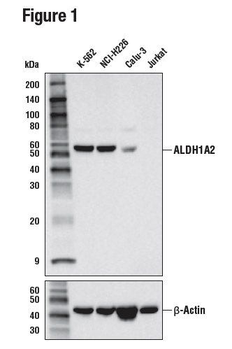 使用 ALDH1A2 (E6O6Q) 对多种细胞系的提取物进行蛋白质印迹分析。
