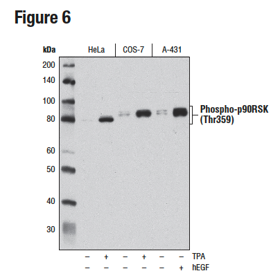 使用 Phospho-p90RSK (Thr359) (D1E9) 对 HeLa、COS-7 和 A-431 细胞的提取物进行蛋白质印迹分析