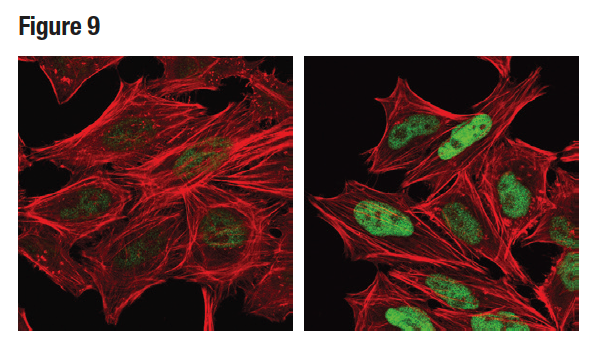 使用 Phospho-c-Jun (Ser73) (D47G9)（绿色）对 Hela 细胞进行共聚焦免疫荧光分析