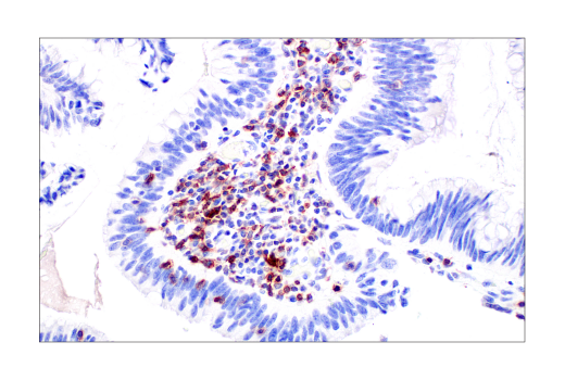 对人结肠腺癌细胞进行免疫组织化学实验表明 TIGIT 呈阳性。