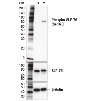 对经 Human Anti-CD3/CD28 T Cell Activation Kit #70976 处理的 Jukat 细胞进行蛋白质印迹分析