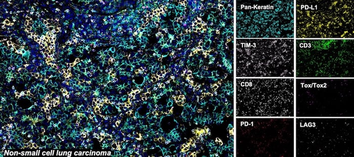 对石蜡包埋的人非小细胞肺癌组织进行 SignalStar™ 多重免疫组织化学分析