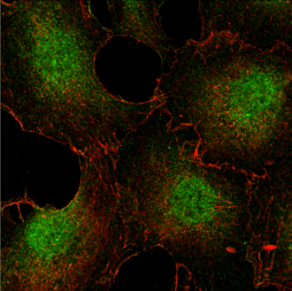 Left_immunofluorescent analysis using Phospho-p44_42 MAPK_U0126 treated_small