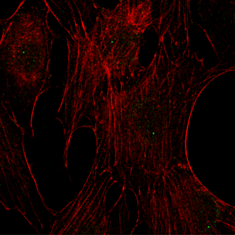 Right_immunofluorescent analysis using Phospho-p44_42 MAPK_PDGF treated_small