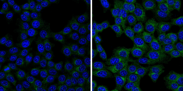 Autophagy_mTOR inhibitor_Phospho-Atg14 (Ser29)