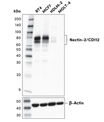 Nectin-2_CD112 正交抗体验证蛋白质印迹法