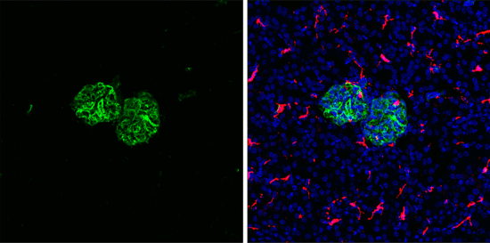 使用 Vimentin Antibody 对小鼠肾脏组织进行免疫荧光分析