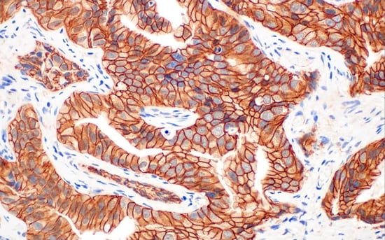 8480_IHC 分析 β 连环蛋白抗体 EMT 信号转导