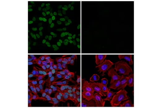 使用 EMT 调节剂 TWIST1 Antibody 进行免疫荧光分析