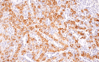 24326_使用 CD16 抗体进行 IHC 分析