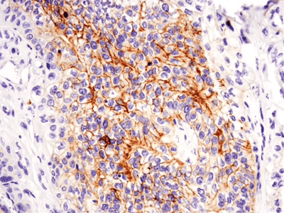 37805_使用 CD117c-kit 抗体进行 IHC 分析