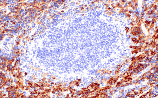 对髓系细胞标记物 CD11b 进行 IHC 分析