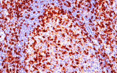 48274_使用 CD4 抗体对辅助性 T 细胞进行 IHC 分析