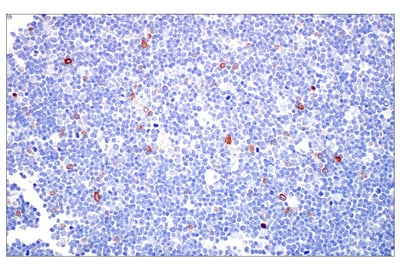 55750_使用 TRDC 对 δγ 细胞进行 IHC 分析