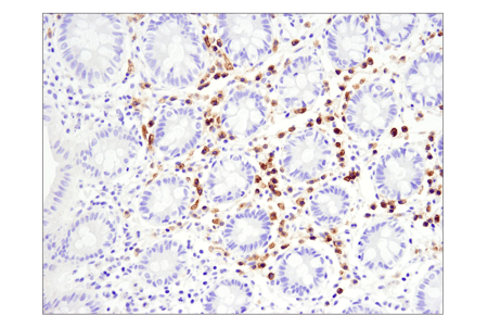 88183_使用 BCMA 对浆细胞进行 IHC 分析