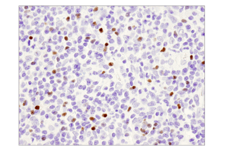 98377_使用 FoxP3 对调节性 T 细胞进行 IHC 分析