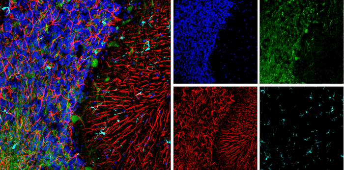 95717_GFAP UHCL1 antibody cerebellum
