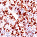 99567 TIGIT IHC 抗体_癌症_B 细胞非霍奇金淋巴瘤缩略图