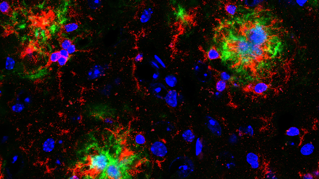 中枢神经损伤和神经退行性疾病研究的星形胶质细胞激活标记物