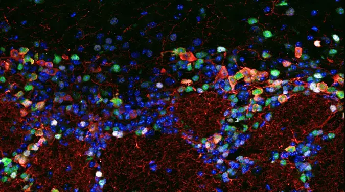 设计基于嵌合抗体的神经科学多重免疫荧光实验